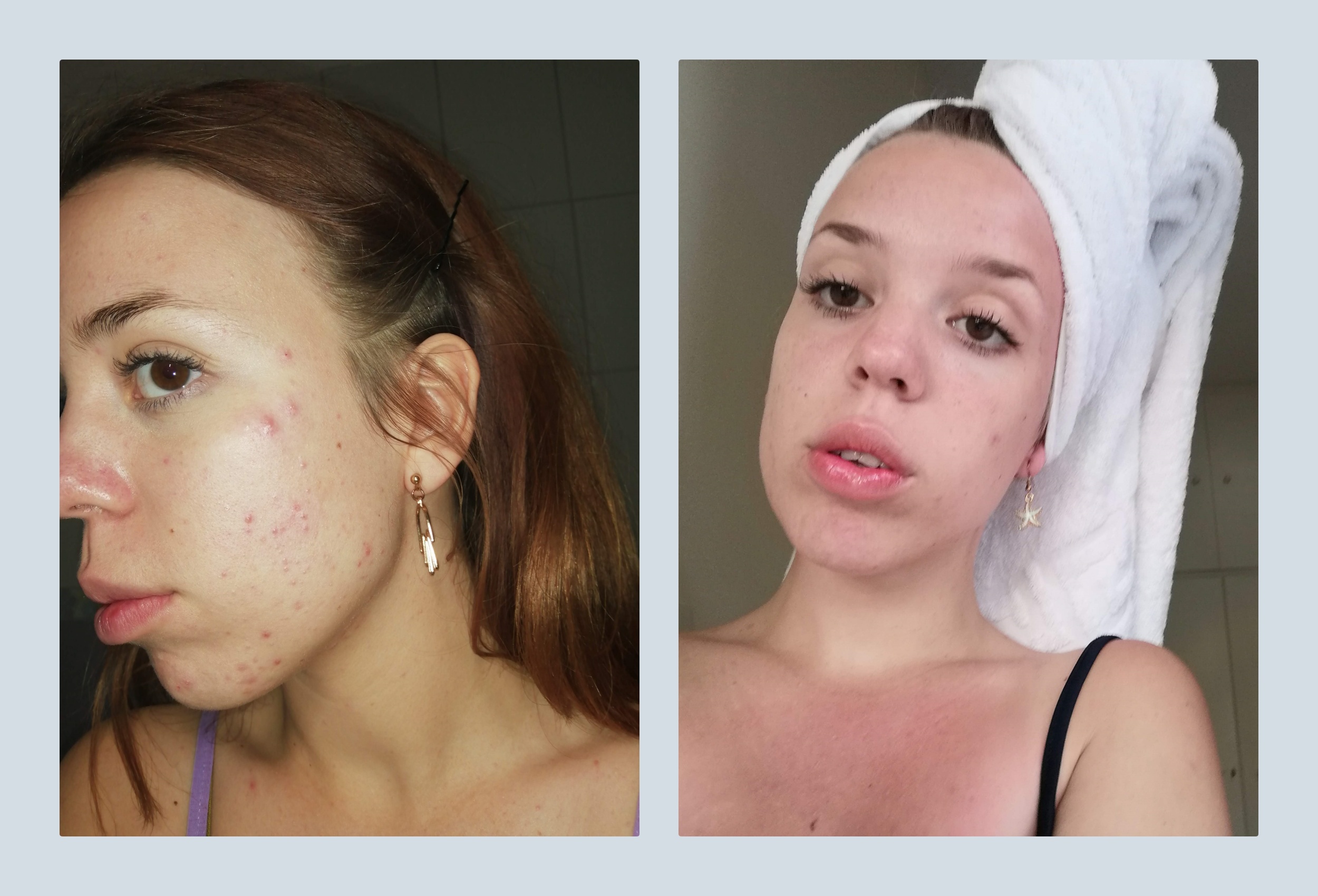 collage