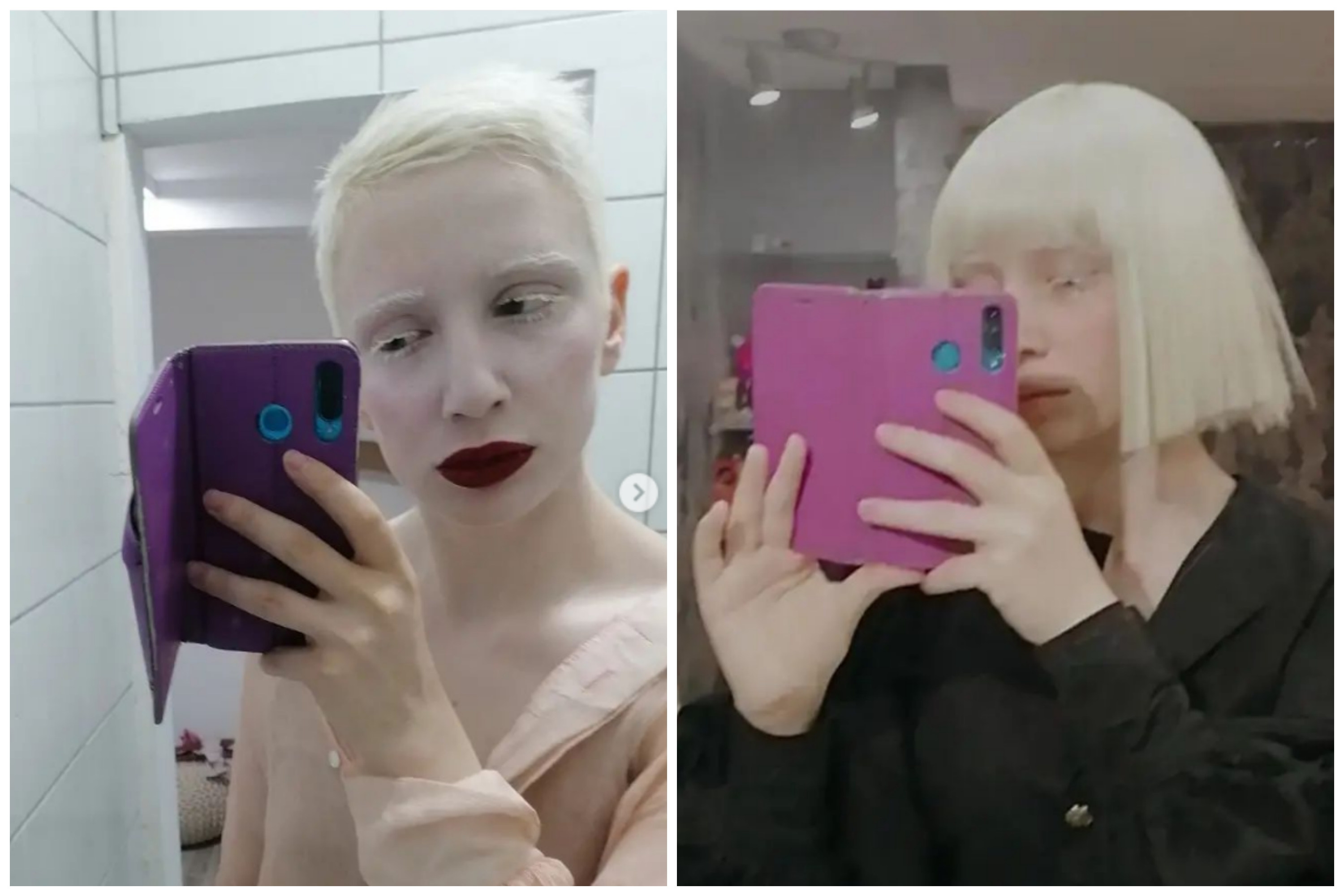 albino