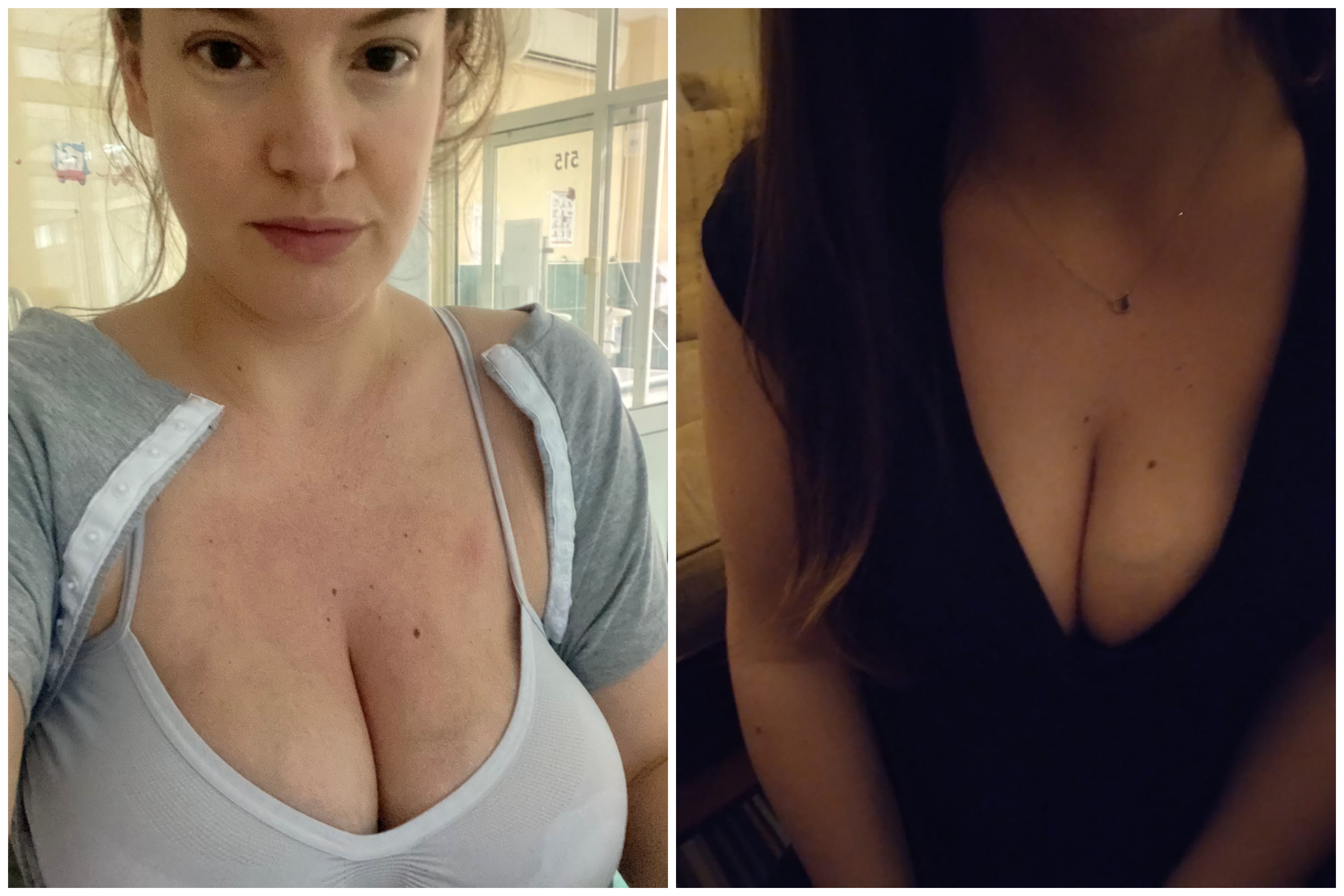 collage