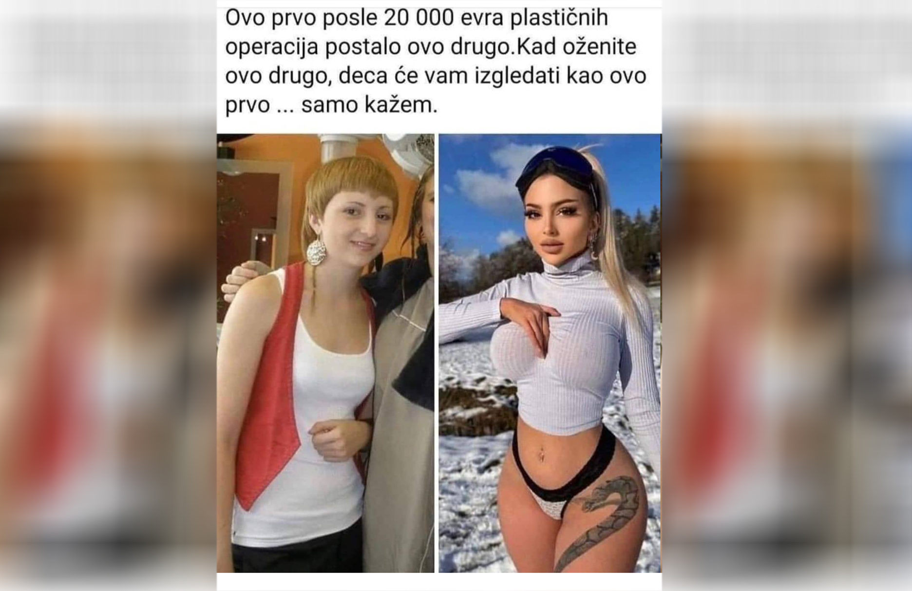 operacija