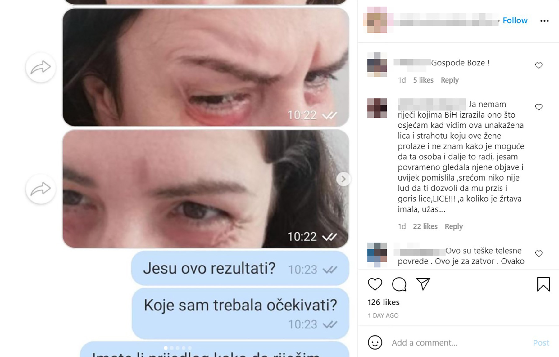 brazilska ožiljci