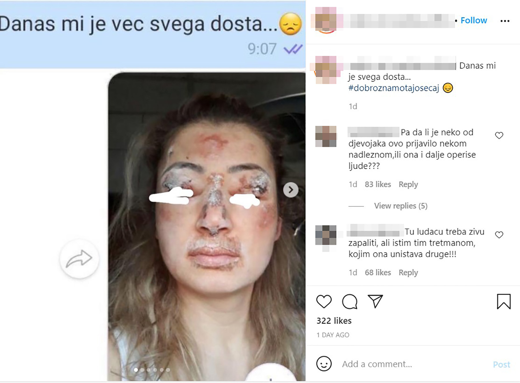 brazilska ožiljci