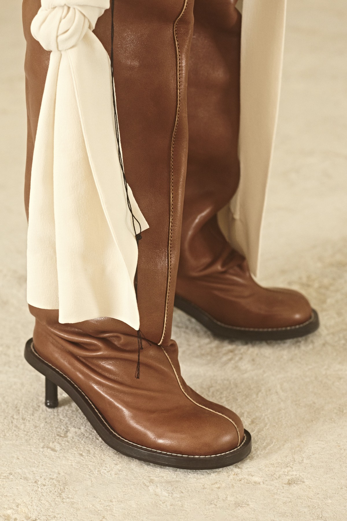 Acne